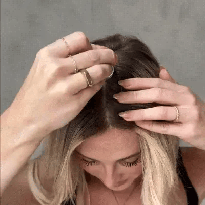 Lexora micro needling hair therapy